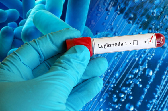 Legionella: Valutazione e gestione del rischio